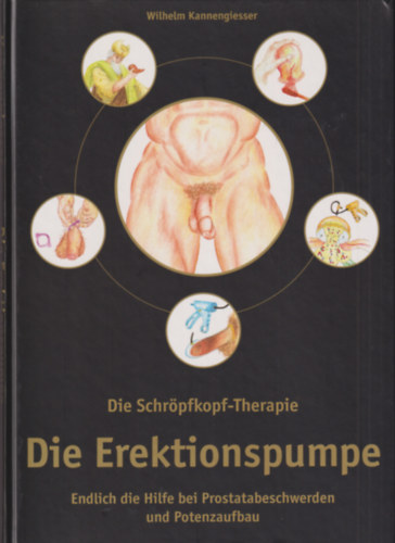 Die Schr�pfkopt-Therapie: Die Erektionspumpe
