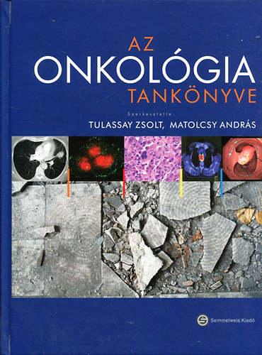 Tulassay Zsolt - Matolcsy Andrs szerk - Az onkolgia tanknyve