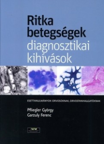 Ritka betegsgek, diagnosztikai kihvsok