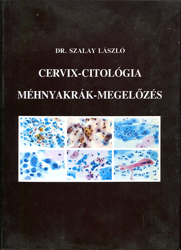 Cervix-Citolgia-Mhnyakrk-megelzs