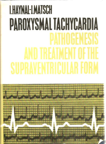 Paroxysmal tachycardia -  Paroxysm�lis tachikardia
