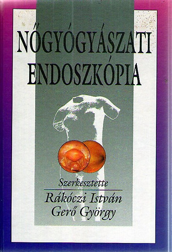 Ngygyszati endoszkpia