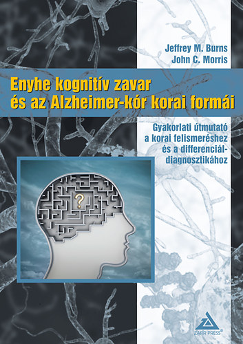 Morrison, John; Burns, M. Jeffrey - Enyhe kognitv zavar s az Alzheimer-kr korai formi