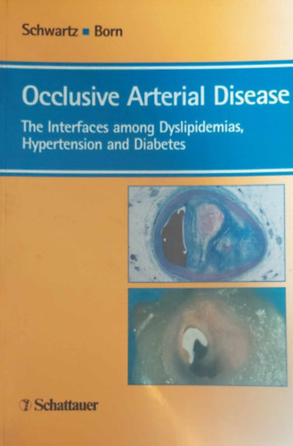Occlusive Arterial Disease (Elzrdsos artris betegsgek -  angol nyelv)