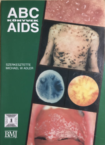 ABC Knyvek AIDS