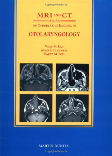 Adam E. Flanders, Barry M. Tom Vijay M. Rao - MRI and CT Atlas of Correlative Imaging in Otolaryngology