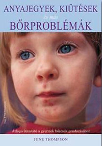 June Thompson - Anyajegyek, ki�t�sek �s m�s b�rprobl�m�k - �tfog� �tmutat� a gyermek b�r�nek gondoz�s�hoz