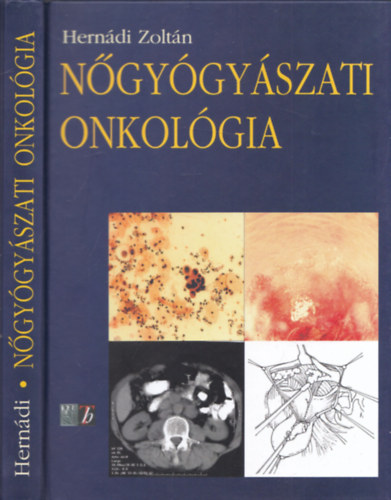 Ngygyszati onkolgia