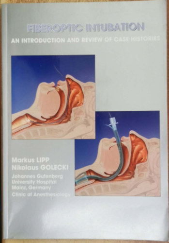 Markus & GOLECKI Nikolaus LIPP - Fiberoptic intubation: an introduction and review of case histories