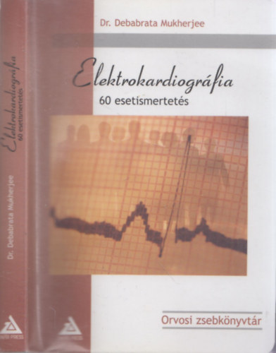 Elektrokardiogrfia - 60 esetismertets (Orvosi Zsebknyvtr)
