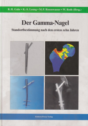 K.S. Leung, M. P. Rosenwasser, W. Roth R. H . Gahr - Der Gamma-Nagel