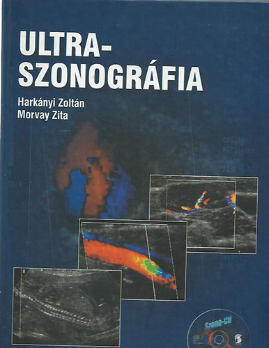 Ultraszonogr�fia