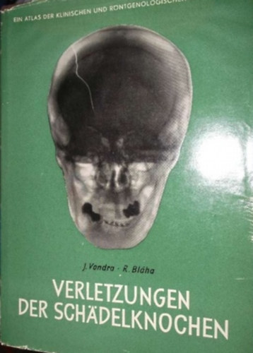 Verletzungen der Sch�delknochen