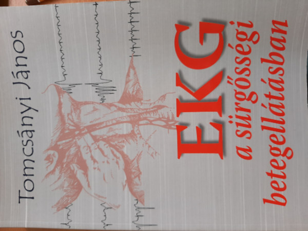 EKG a srgssgi betegelltsban
