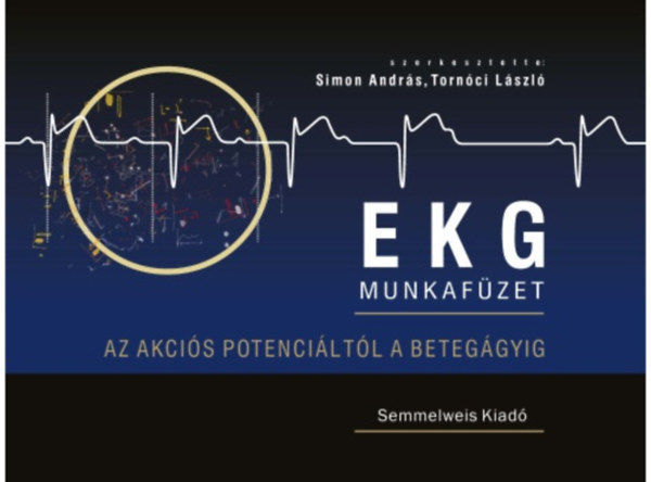 EKG �rthet�en. Az akci�s potenci�lt�l a beteg�gyig