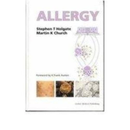 Allergy (Allergia - angol nyelv)