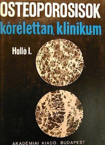 Dr. Holló István - Osteoporosisok - Kórélettan, klinikum