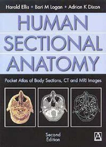 Human Sectional Anatomy: Pocket Atlas of Body Sections, CT and MRI Images