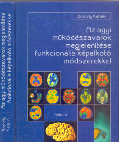 Dr. Lektorlta: Prof. Dr. Szirmai Imre Borbly Katalin - Az agyi mkdszavarok megjelentse funkcionlis kpalkot mdszerekkel (Sznes s fekete-fehr brkkal)