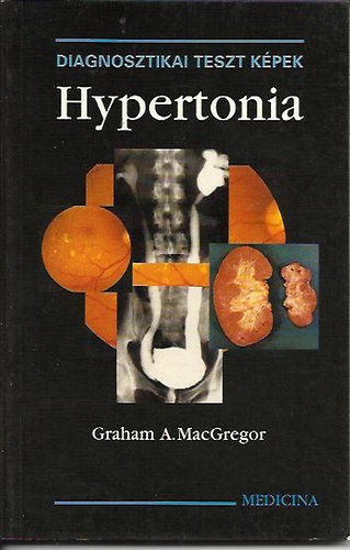 Graham A. MacGregor - Hypertonia