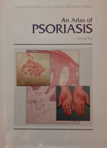 Lionel Fry - An Atlas Of Psoriasis (The Encyclopedia Of Visual Medicine Series)