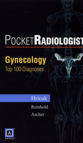 Pocket Radiologist: Gynecology - Top 100 Diagnoses