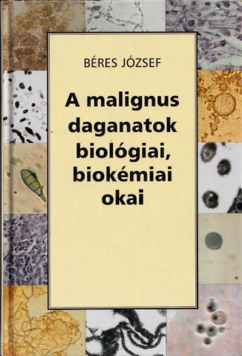 B�res J�zsef - A malignus daganatok biol�giai, biok�miai okai