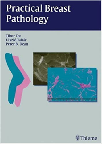 László Tabár, Peter B. Dean Tibor Tot - Practical Breast Pathology
