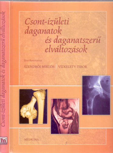 Szerkesztette: Szendri Mikls - Vzkelety Tibor - Csont-zleti daganatok s daganatszer elvltozsok