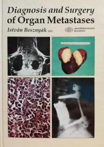 Diagnosis and Surgery of Organ Metastases