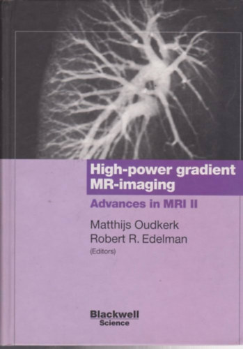 Robert R. Edelman Matthijs Oudkerk - High-power Gradient MR Imaging: Advances in MRI II