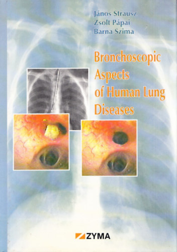 Strausz-P�pai-Szima - Bronchoscopic Aspects of Human Lung Diseases