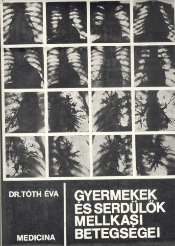 Gyermekek s serdlk mellkasi betegsgei