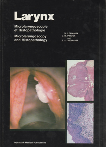 Larynx - Microlaryngoscopie et Histopathologie