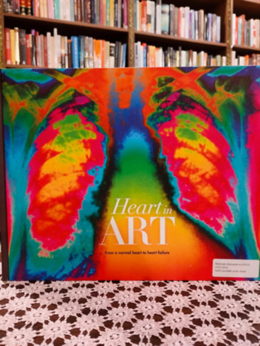 Hart in art. From a normal heart to heart failure. /Az eg�szs�ges sz�vt�l a sz�vel�gtelens�gig/