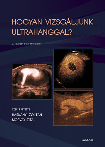 Hogyan vizsgljunk ultrahanggal?