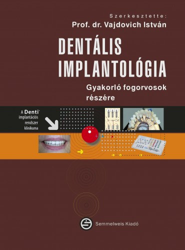 Dr. Vajdovich Istvn - Dentlis implantolgia - Gyakorl fogorvosok rszre