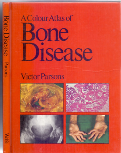 A Colour Atlas of Bone Disease