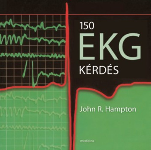 150 EKG k�rd�s
