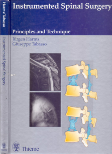 Instrumented Spinal Surgery - Principles and Technique (503 illustrations)
