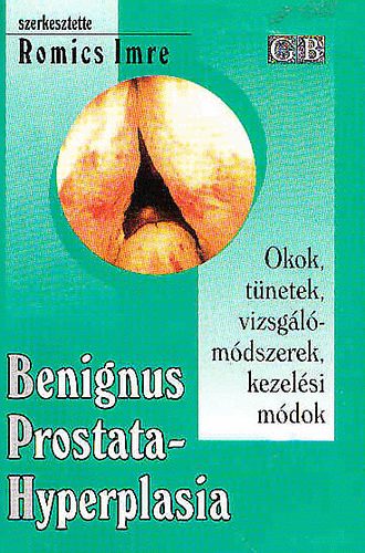 Romics Imre - Benignus prostatahyperplasia