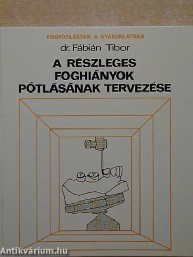 Dr. Fbin Tibor GRAFIKUS Vrbel Ferenc - A rszleges foghinyok ptlsnak tervezse - Fogptlstan a gyakorlatban