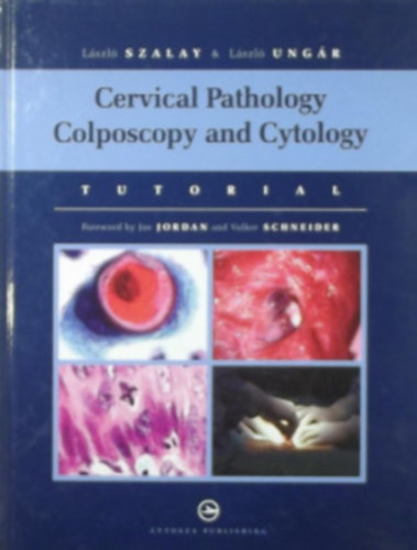Cervical Pathology Colposcopy and Cytology - Mhnyak patolgia Kolposzkpia s citolgia