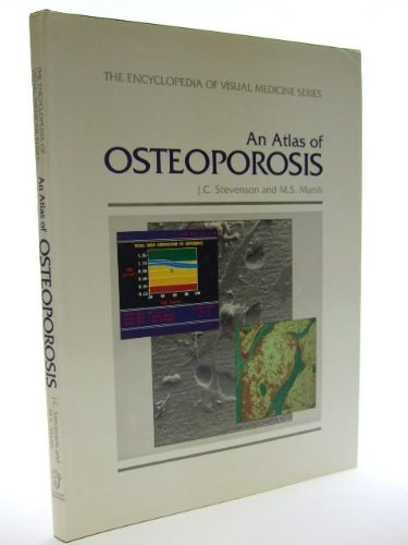 J.C. Stevenson, M.S. Marsh - An Atlas of Osteoporosis