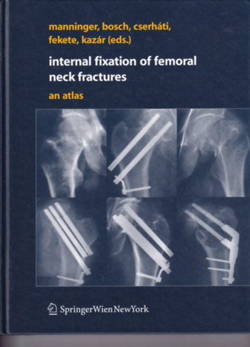 Internal Fixation of Femoral Neck Fractures