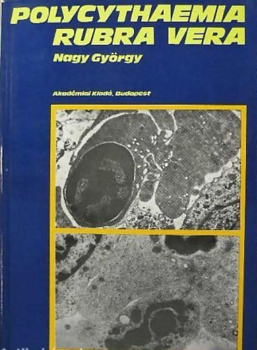 Polycythaemia Rubra Vera klinikuma, pathologi�ja �s korszer� kezel�se
