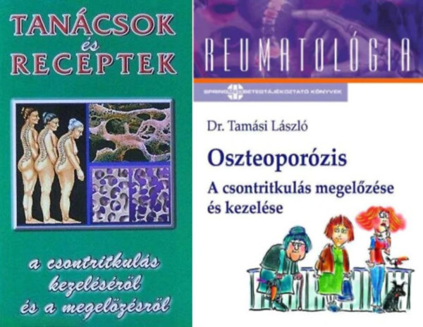 2 db m a csontritkuls kezelsrl: Oszteoporzis - A csontritkuls megelzse s kezelse + Tancsok s receptek a csontritkuls kezelsrl s a megelzsrl