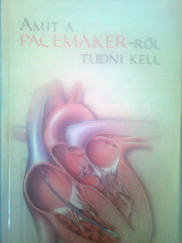 Amit a pacemaker-rl tudni kell